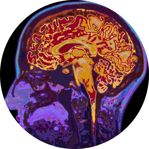 Brain Health